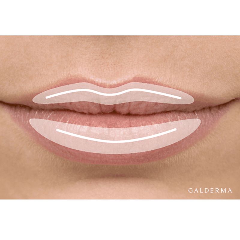 GAL-GLO-RES-IMG_Kysse_Lippenvolumen_rz