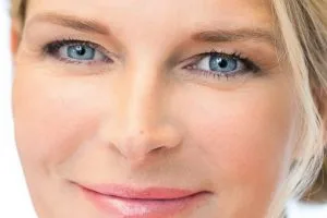 hyaluron-behandlung-mittleres-gesicht-aesthetik-first-lounge-de
