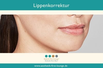 lippen-korrektur-mit-hyaluron-aesthetik-first-lounge