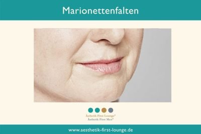 marionettenfalten_aesthetik-first-lounge