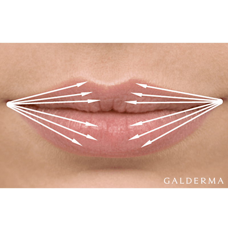 trockene-lippen-mit-hyaluron-behandeln_aesthetik-first-lounge-berlin